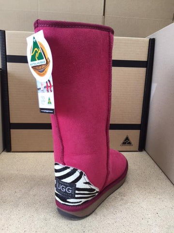 RUBY / ZEBRA TALL UGG BOOTS